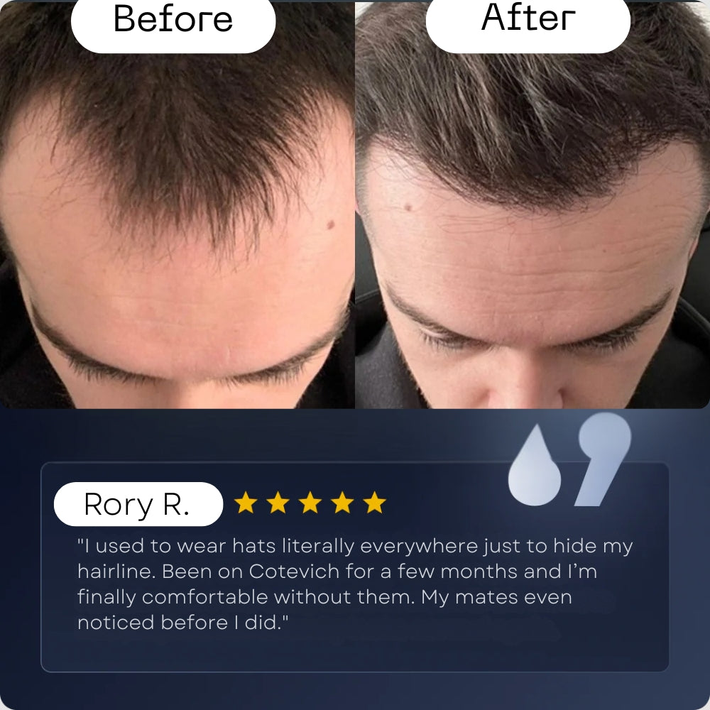 DermaPro Roll