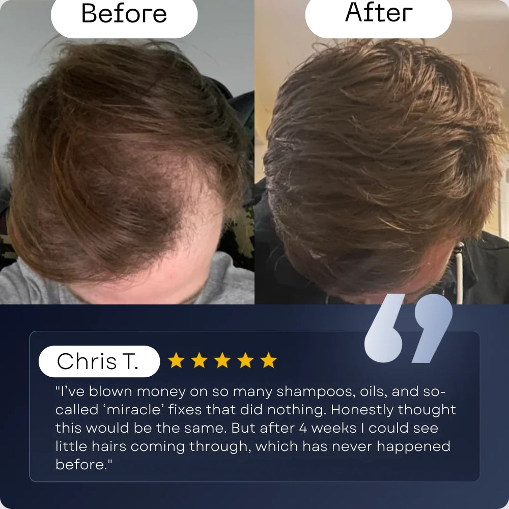 DermaPro Roll