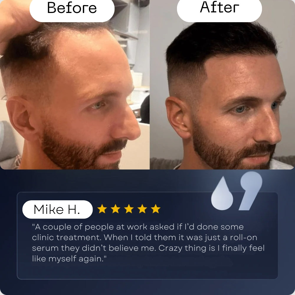 DermaPro Roll