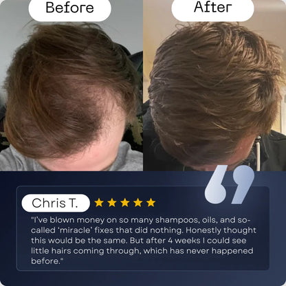DermaPro Roll