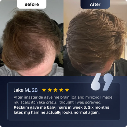 Hair Growth Serum Roll On